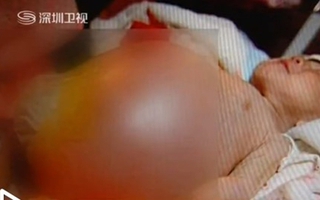 Bé trai 2 tuổi mang thai