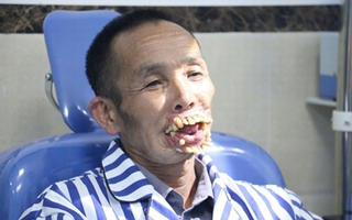 Phẫu thuật tái tạo gương mặt cho nạn nhân bị chó sói tấn công