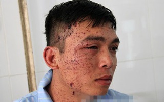 Lời kể kinh hoàng của con trai trong vụ bố ôm mìn tự sát