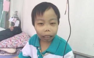 Thiếu gia xấu xí Trần Sơn chỉ là chiêu trò quảng cáo?