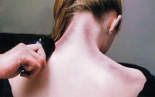 Đánh gió - phương pháp chữa bệnh độc đáo
