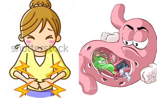 Tất cả những điều bạn cần biết về ung thư dạ dày