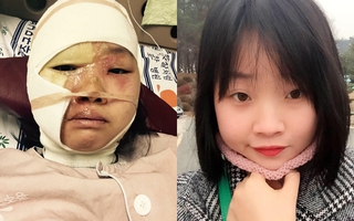 Nghĩ quẩn, buông xuôi không thể đem bạn trở về từ cõi chết, như câu chuyện của cô gái này