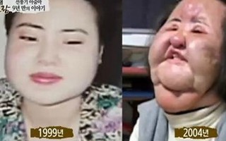 Cuộc sống cô đơn của "Thảm họa thẩm mỹ" Han Mi Ok