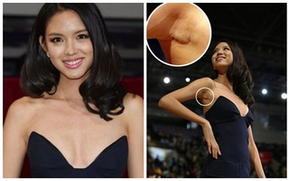 Trương Tử Lâm sẽ chứng minh không nâng ngực