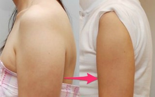 Tuyệt chiêu thu gọn bắp tay cực kì hiệu quả chỉ trong 7 ngày