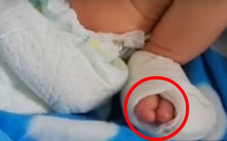 Nữ y tá bị bắt vì cắt đứt gần 2 ngón chân của bé gái mới 2 ngày tuổi