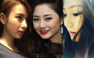 Những sao Việt trẻ "lột xác" nhờ nâng mũi 