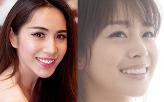 Cận cảnh phương pháp bọc răng thẩm mỹ giúp các sao "thăng hoa nhan sắc"