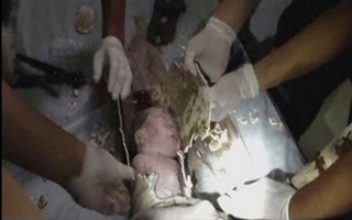 Giải cứu bé sơ sinh trong đường ống toilet