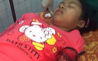 Bắt khẩn cấp 2 nghi can bịt mặt dùng dao đâm nữ sinh trong đêm