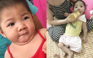 Hình ảnh mới của bé gái Lào Cai 14 tháng tuổi nặng 3,5kg sau hơn 3 tháng được mẹ nuôi chăm sóc