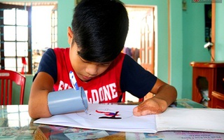 Cậu học trò nghèo gắn ống nhựa vào đôi tay cụt để vẽ ước mơ đời mình
