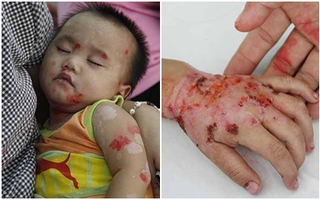 "Con chưa một lần được nhìn mặt cha giờ lại chịu đau đớn thể xác thế này"