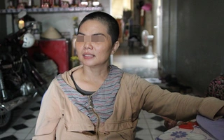 Vụ chồng gây tai nạn cho vợ: Chồng gặp vợ hòa giải, đền bù 50 triệu đồng