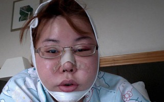 Hành trình đau đớn vì nhan sắc 