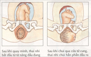 "Cận cảnh" 3 giai đoạn của quá trình sinh nở mẹ bầu cần biết
