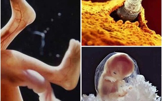 Bộ ảnh tuyệt vời chụp trong 12 năm về sự lớn lên của thai nhi trong bụng mẹ