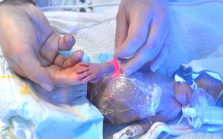 Bà mẹ sinh năm, em bé nhỏ nhất chỉ nặng nửa cân