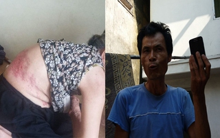 Vụ mẹ già 81 tuổi tố con trai đánh đập đuổi khỏi nhà: Không phải con đánh mà do mẹ vu vạ?