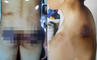 Vụ bé 12 tuổi ở Lào Cai bị bố đẻ, mẹ kế hành hạ: Mẹ kế đã đi khỏi địa phương