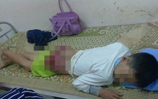 Lào Cai: Bé trai 12 tuổi bị bố và mẹ kế dùng chày đánh bầm dập đầu, mặt và mạng sườn