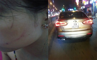 Hà Nội: Cô gái trẻ bị tài xế dừng xe ô tô tát “đỏ má” vì không cho vượt?