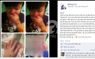 Thiếu nữ Hải Dương đăng ảnh mặt đầy máu trên Facebook để tỏ lòng hiếu thảo với mẹ