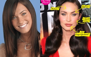 Megan Fox và công cuộc đại tu nhan sắc bằng "dao kéo"
