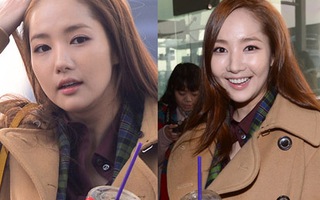 Park Min Young cũng bắt đầu bị mặt sưng phù và cười lệch hàm