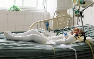 Cháu bé thứ 2 vụ cả nhà bị tưới xăng thiêu sống đã chết