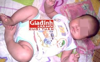 Cô bé lớp 7 sinh con cùng người yêu 15 tuổi