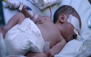 Tin thầy lang vườn, một bệnh nhi nguy kịch