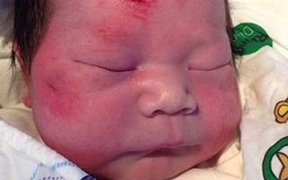 Mẹ bị tai nạn giao thông vẫn cố đẻ con trước khi qua đời