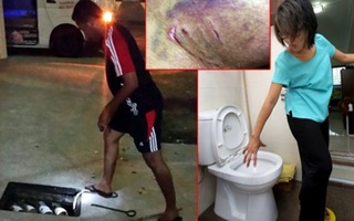 Một phụ nữ nhập viện vì bị trăn chui từ bồn cầu lên cắn vào đùi 