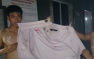 Gần chục người đi đường bị bỏng vì chất độc từ xe ô tô hắt ra