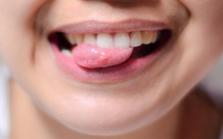 Đoán bệnh của bạn qua những biểu hiện ở lưỡi