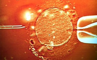 5 hiểu lầm về thụ tinh trong ống nghiệm bạn nên biết