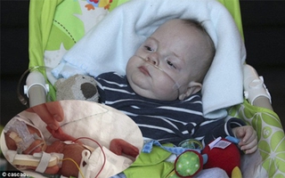 Sự sống kỳ diệu của bé trai nặng 0,5 kg, tim ngừng đập 5 lần khi chào đời