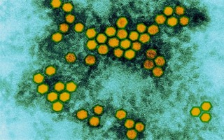 Virus mới gây ra tình trạng tê liệt ở trẻ em trên nước Mỹ