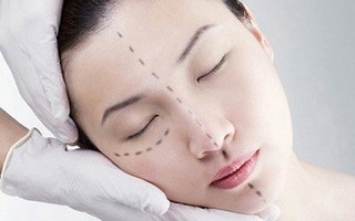 5 rủi ro tân trang nhan sắc bằng phẫu thuật