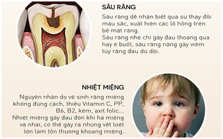 Những bệnh răng miệng thường gặp mà bạn cần lưu ý trong mùa hè