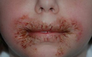 Sự nguy hiểm khó ngờ của một sản phẩm bố mẹ nào cũng từng dùng cho con