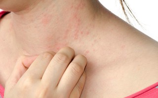 9 dấu hiệu cho thấy đang có quá nhiều chất độc xâm nhập và tích tụ trong cơ thể bạn, mỗi ngày