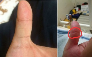 Mắt Phật trên ngón tay là gì mà rất ít người có, đã có là rất đáng quý?