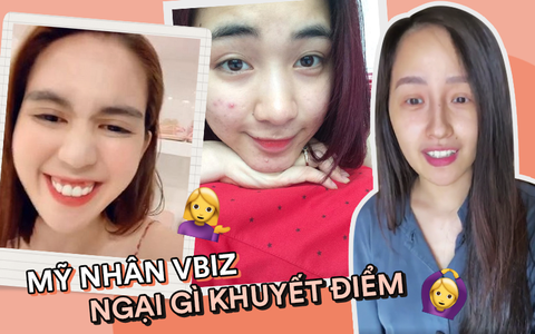 Mỹ nhân Vbiz tự "bóc trần" khuyết điểm: Hòa Minzy gây sốc với mặt mụn chi chít, Mai Phương Thúy như người khác với 0% make up