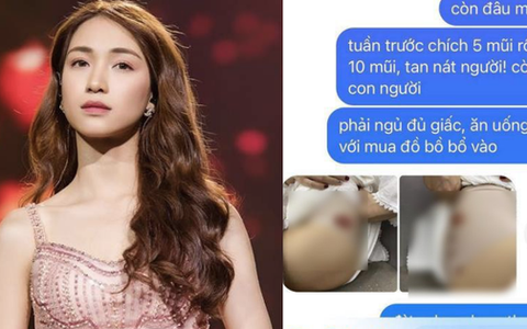Hòa Minzy phải tiêm 10 mũi thuốc sau nhiều ngày dầm mưa đi cứu trợ, xót xa vì vòng 3 rướm máu