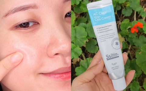 5 lọ kem dưỡng Hàn Quốc “đo ni đóng giày” cho làn da của bạn, dùng xong da đẹp tột bậc không có gì lạ
