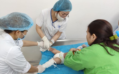 Trẻ bỏng nặng do chạm vào bình ủ sữa