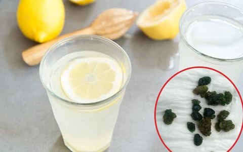 Xổ ra cả đống sỏi gan, sỏi mật nhờ uống dầu ôliu, dầu dừa: Sự thật kinh hoàng phía sau mới là điều bạn cần biết về trào lưu detox đang "làm mưa gió" trên MXH
